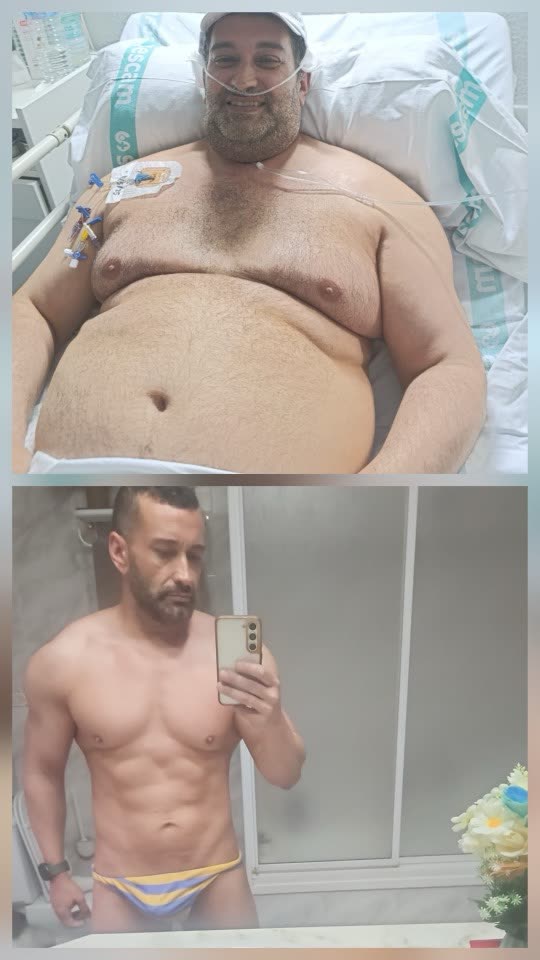 Antes y después de Carlos